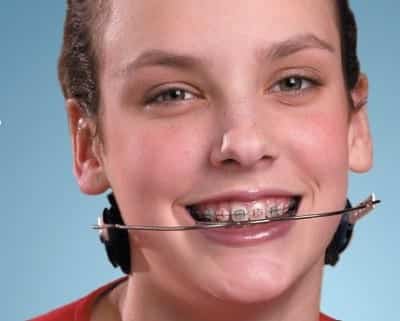 No More Metal Mouth