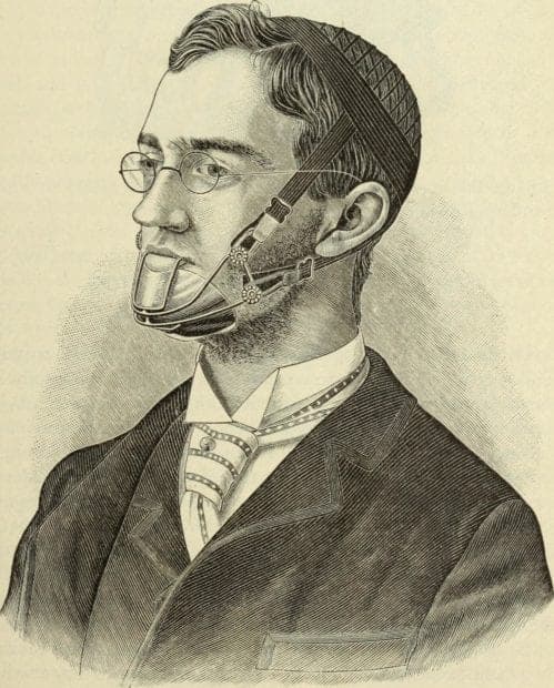 3 Scary Dental Tools of the Past