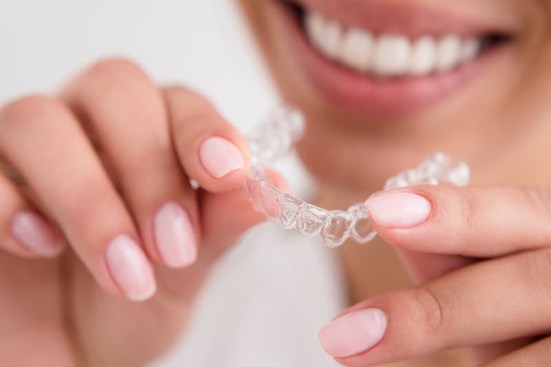 What to Do If Your Clear Aligner Breaks or Is Lost