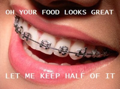 Shot of braces with caption "Oh your food looks great. Let me keep half of it."
