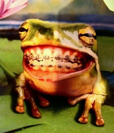 Frog with human teeth and braces