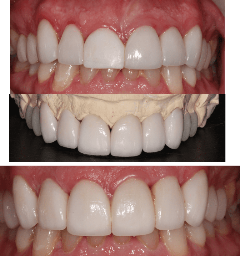 Before & After Photos Arizona Biltmore Dentistry
