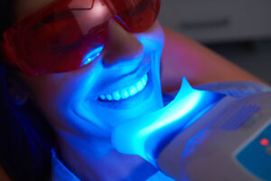 Professional vs At-Home Teeth Whitening: Which to Choose?