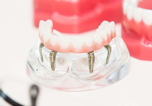 Dentures Phoenix