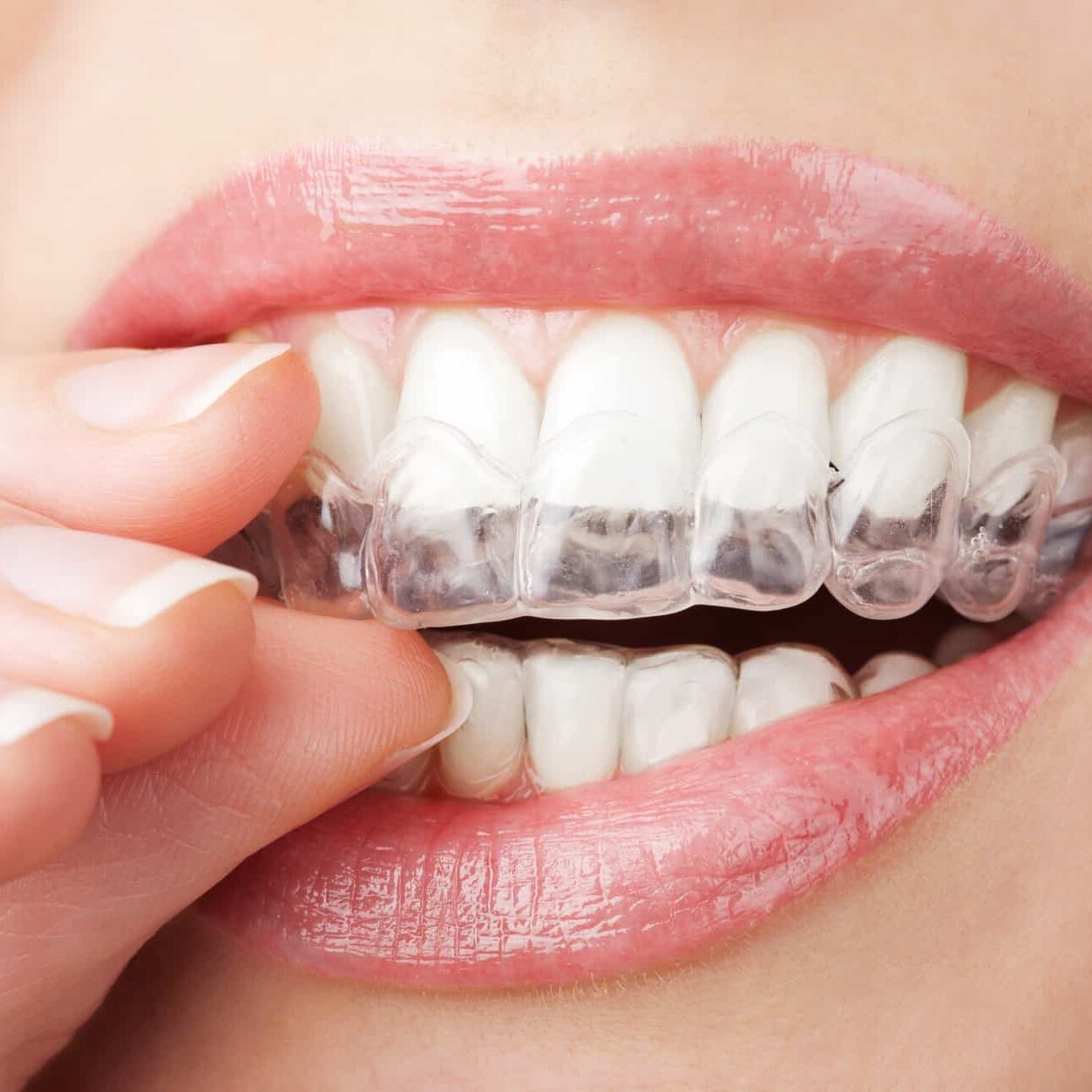 orthodontist
